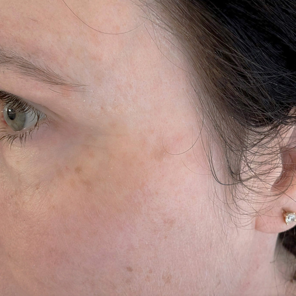 Skin improvement after using Copper Peptide Serum